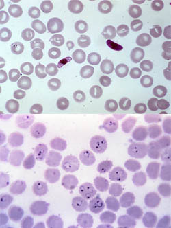 Caracterización del genoma accesible en el parásito de la malaria humana Plasmodium falciparum