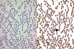 MIZUTAMA: un método rápido, fácil y preciso para contar eritrocitos